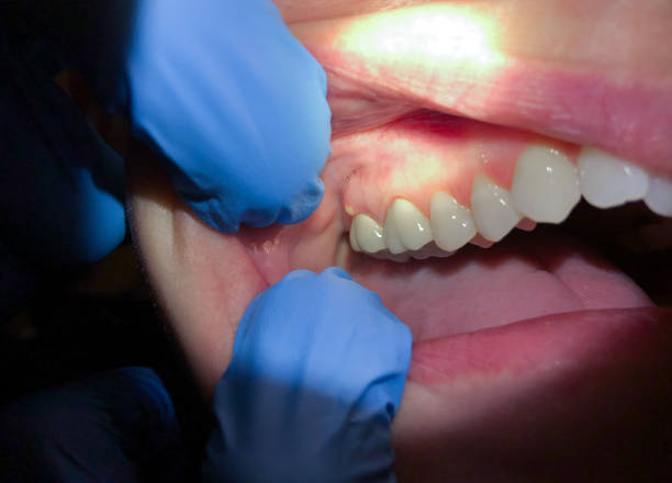Best Weekend Emergency Dentist in Rutgers University Busch Campus, NJ