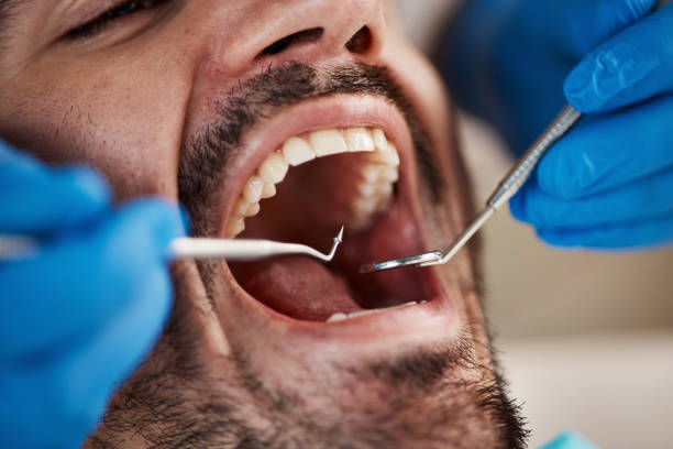 Best Emergency Treatment for Dental Infections or Abscesses in Rutgers University Busch Campus, NJ