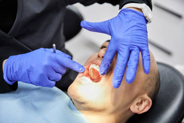  Rutgers University Busch Campus, NJ Emergency Dentist Pros